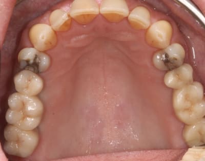 Img 9930 obtwaa - Eugenol