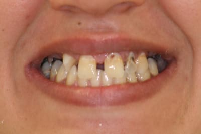 Img 9997 002 rajxwv - Eugenol