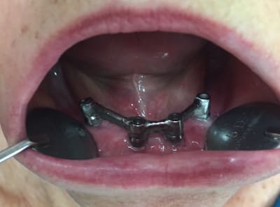 Img e3566 n5hjbl - Eugenol