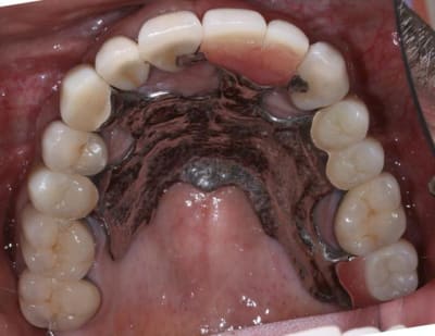 Img ic3 ygb9al - Eugenol