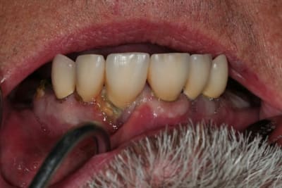 Img initial dd7pez - Eugenol