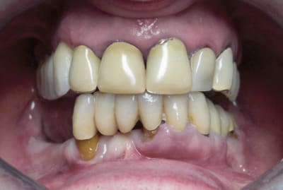 Iniface ui9rgr - Eugenol