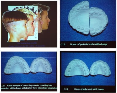 Image 1 qf9ljh - Eugenol