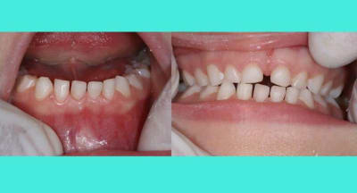 Image 2 ykh7q8 - Eugenol