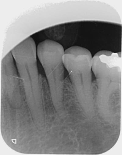 Image000  1  an8tg8 - Eugenol