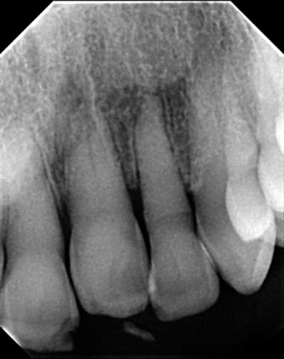 Image001 ojfms6 - Eugenol