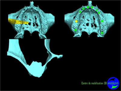 Image11 kjflst - Eugenol
