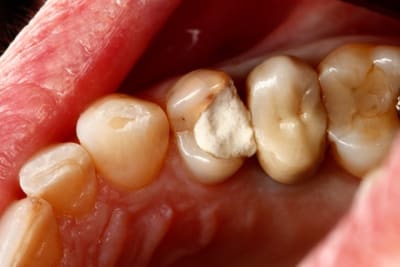 Image12 rhpoot - Eugenol