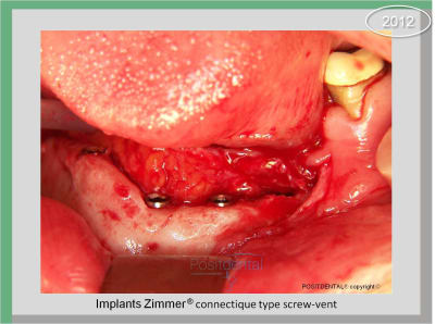 Image15 emjnen - Eugenol