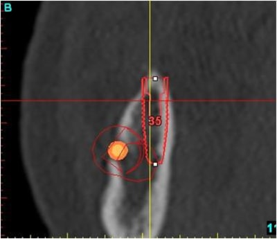 Image15 erebpf - Eugenol