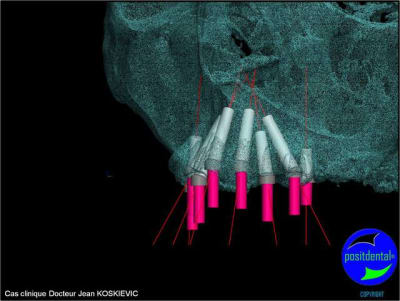 Image15 uumazx - Eugenol