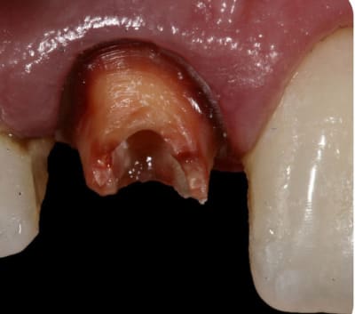 Image1 joteiz - Eugenol