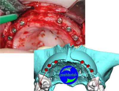Image1 nfm3ug - Eugenol