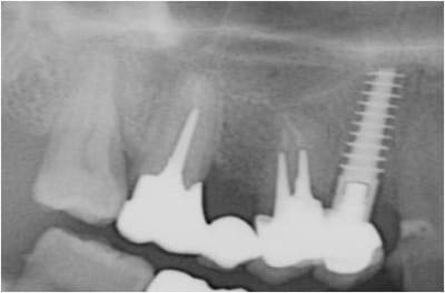 Image1 oi5pho - Eugenol