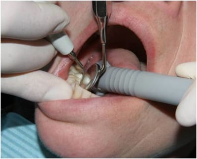 Image1 t31jpo - Eugenol