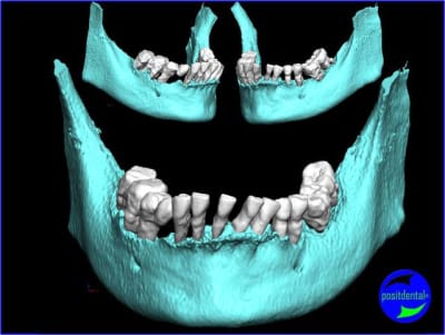 Image1 vsmeau - Eugenol