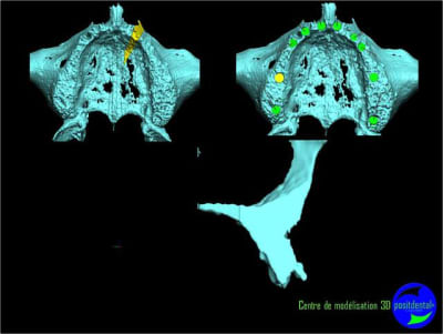 Image20 nbeugx - Eugenol