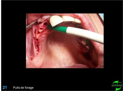 Image21 tahfpq - Eugenol