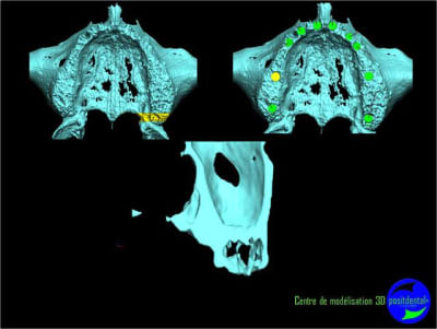 Image29 tjlmpc - Eugenol