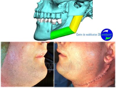 Image2 ekgxtm - Eugenol