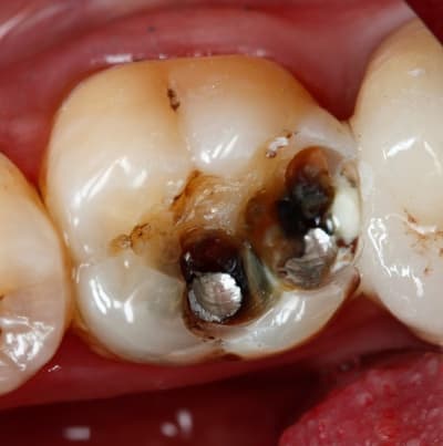 Image2 yzdpzw - Eugenol