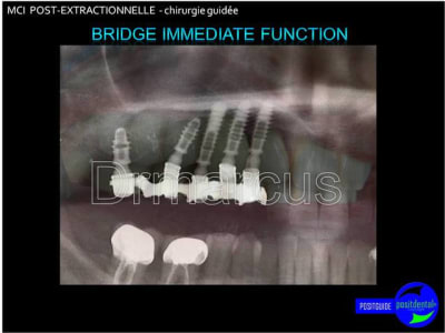 Image31 cli5fx - Eugenol