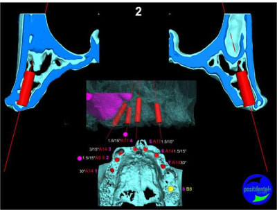 Image33 nwzawb - Eugenol