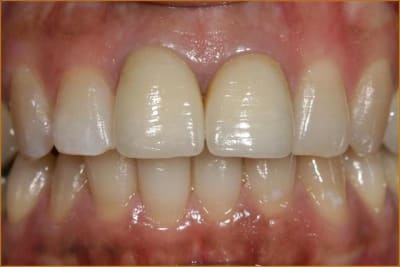 Image3 a1dufr - Eugenol
