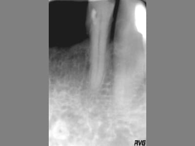 Image3 hiny8f - Eugenol