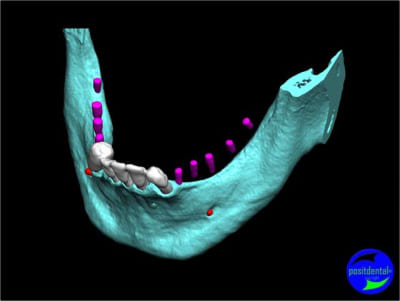 Image3 nbg7re - Eugenol