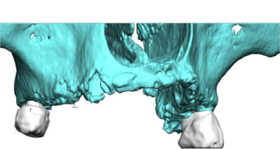 Image3 rodo0r - Eugenol