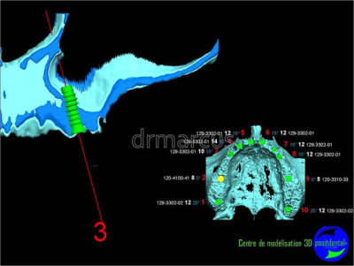 Image40 wn96nw - Eugenol