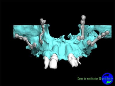 Image4 lvqmjv - Eugenol