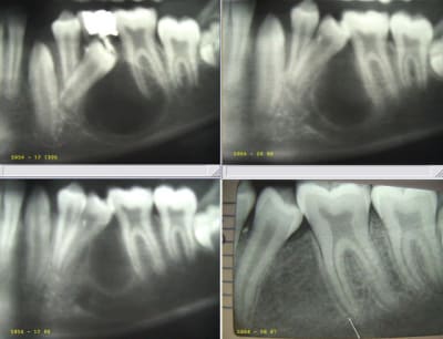 Image4 meixqh - Eugenol