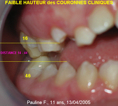 Image4 nsthlp - Eugenol
