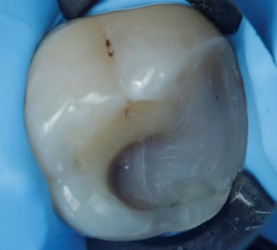 Image5 abpg83 - Eugenol