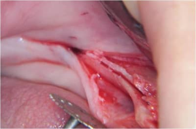 Image5 djpkgy - Eugenol