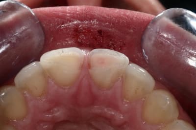 Image9 ujmmla - Eugenol