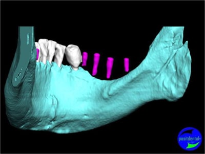 Image9 x5l3ok - Eugenol