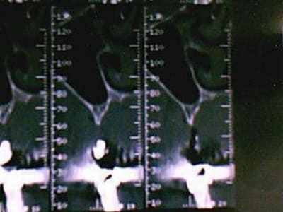 Image 003 uiri3w - Eugenol