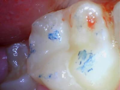 Image 012 x04l1h - Eugenol
