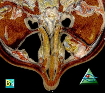 Image 2 nqxzpp - Eugenol