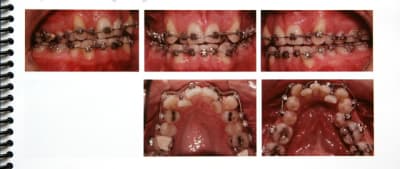 Image 2 zrmlm3 - Eugenol