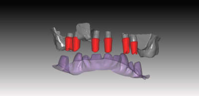 Image bi4n5l - Eugenol