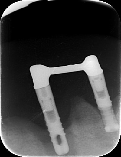 Image epo0bo - Eugenol