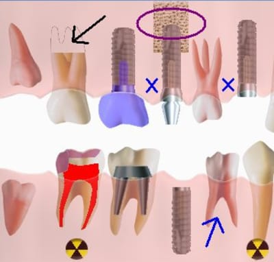 Image schema1 m5yrum - Eugenol