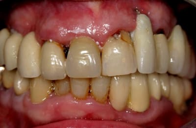 Img 1387 lexebb - Eugenol