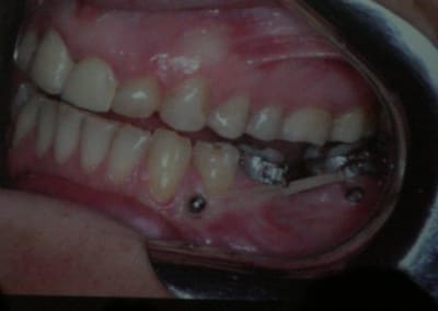 Img 1983 whjff8 - Eugenol