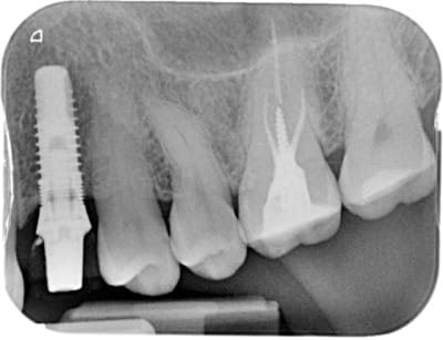 Inconnu x 20151105 174002 xbsabtr78lfg 4 v5ckbd - Eugenol