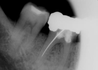 Jc2 plj5wn - Eugenol